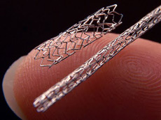 Μεταλλικό stent καρωτίδας